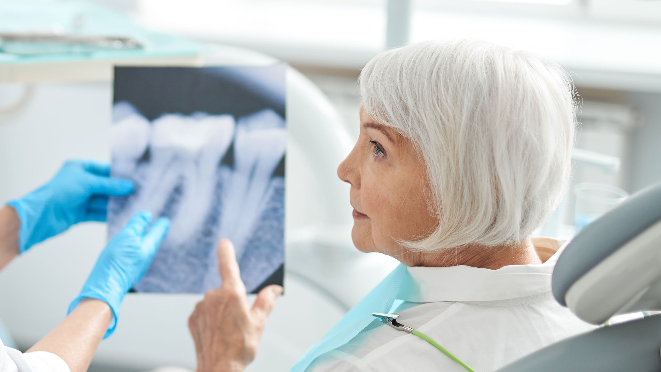 Dental Cleaning & Consultation Alkass Dental